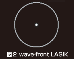 図2 wave-front LASIK