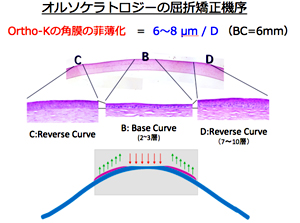 オルソケラトロジーの屈折矯正機序