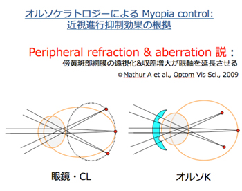 近視進行抑制効果の根拠